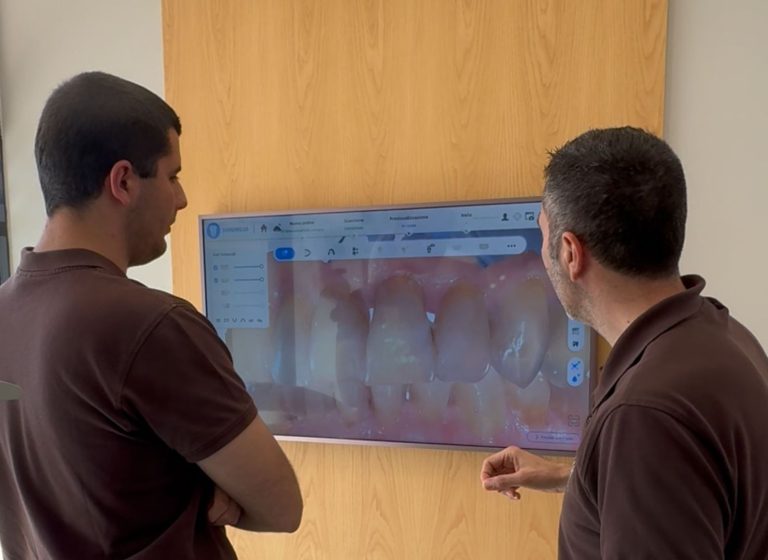 cause della parodontite