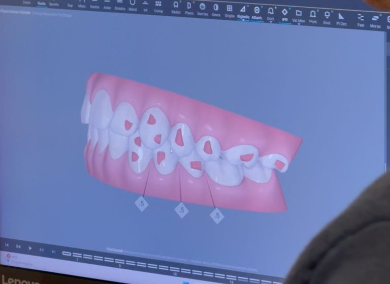 apparecchio trasparente